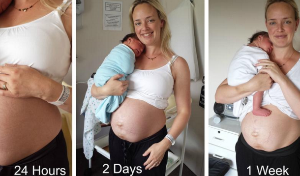 My real postpartum body: the brutiful truth, The Independent