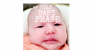 ugly, baby, phase, newborn, 5 weeks, baby acne, cradle cap, comedy, mr. burns
